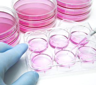 Mammalian Cell Cultures