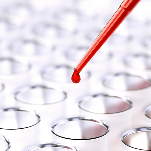 rapid and reproducible dna isolation from 1 ml of whole blood