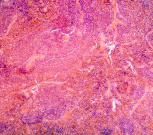 Micrograph of pancreas tissue, typical pancreatic tissue in the jejunum tissue. Image: Pan Xunbin/Shutterstock.com.