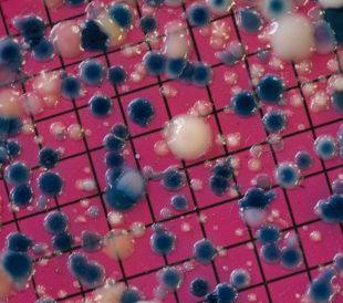 Escherichia coli colonies growing on an agar plate. Image: ggw/Shutterstock.com