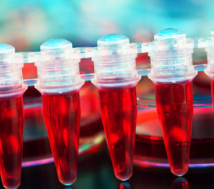 Stem cells for treating cancer in a microtube. Image: Science photo/Shutterstock.com