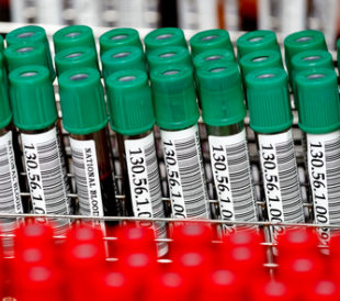 Blood samples in tubes. Image: Sura Nualpradid/Shutterstock.com