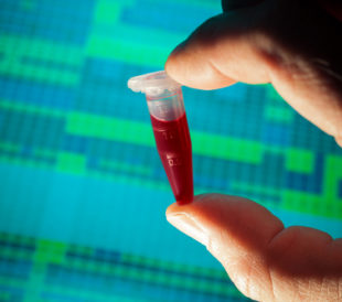 Test tube with genetic results in the background. Image: science photo/Shutterstock.com