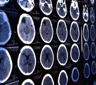 Images from a computerized tomography of the brain. Image: nimon/Shutterstock.com.