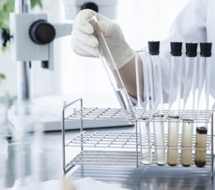 Close-up of the test tube. Glass products of medical care. Image: Leonardo da/Shutterstock.com.
