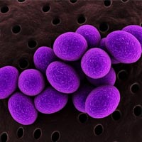 Fact sheet on Staphylococcus - Examining Food