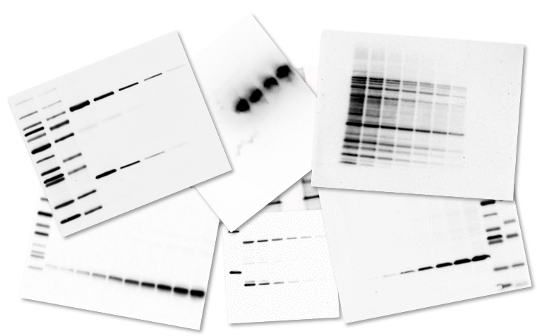 ウェスタンブロッティングの製品選びにもう困らない！第2回：総