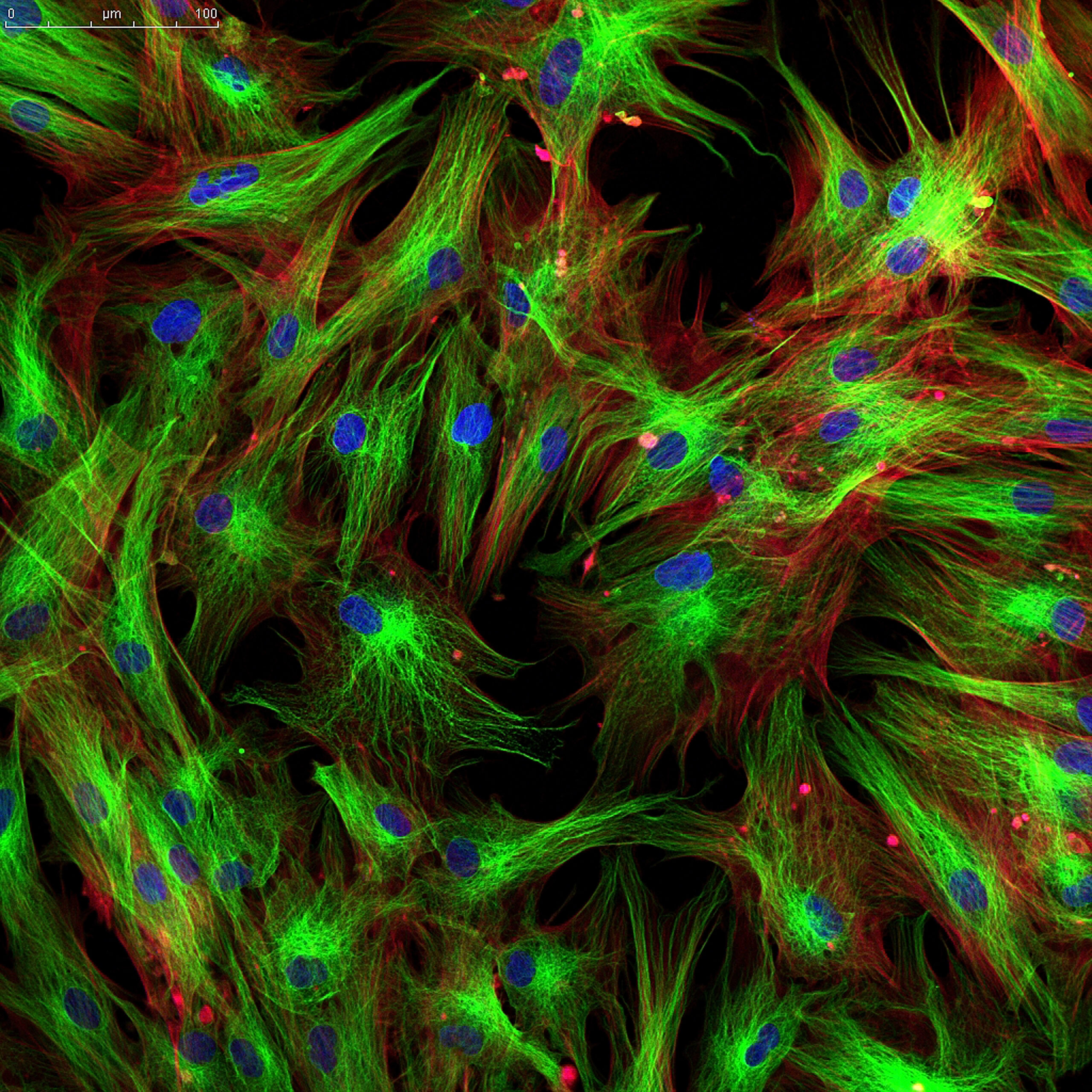Cell Painting Assayで用いられる試薬について (Hoechstを用いた核染色