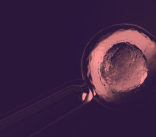 In vitro fertilization under magnification
