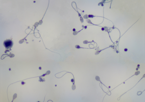 semen under microscope